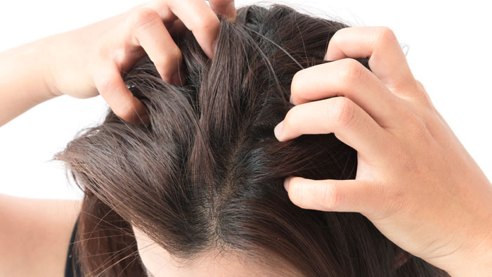 علاج حكة فروة الرأس وتساقط الشعر